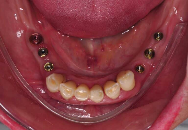 Sicuti Odontologia 3 DSC 0073